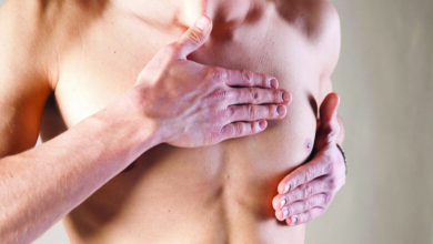 How Gynecomastia Surgery in Riyadh Boosts Confidence