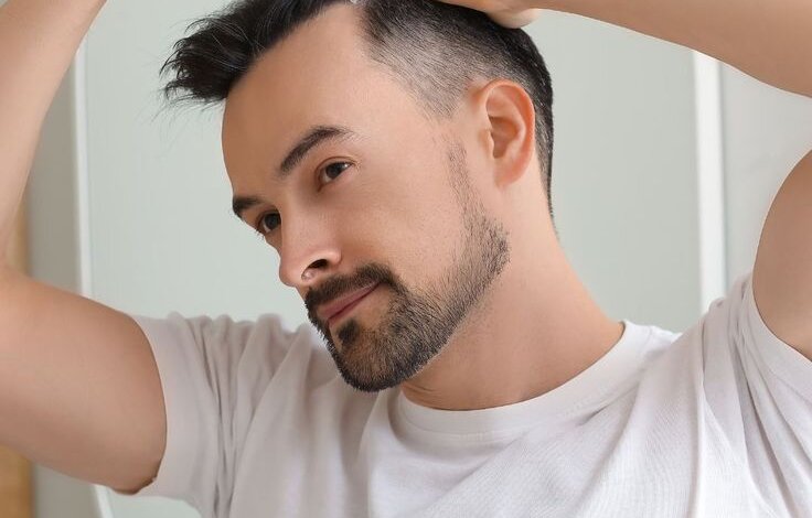 Affordable Hair Transplants in Riyadh Explained