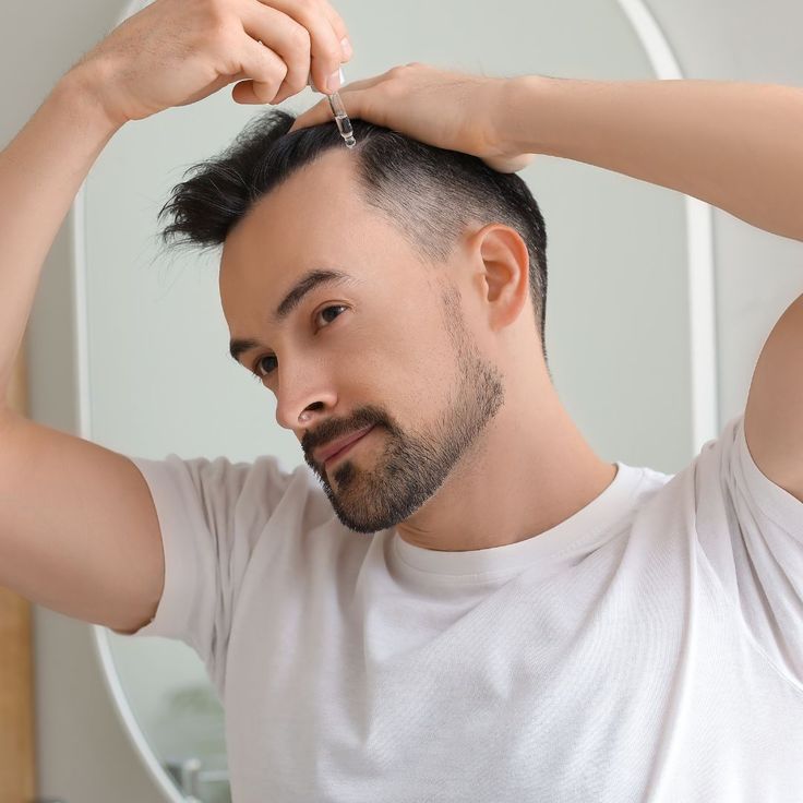 Affordable Hair Transplants in Riyadh Explained