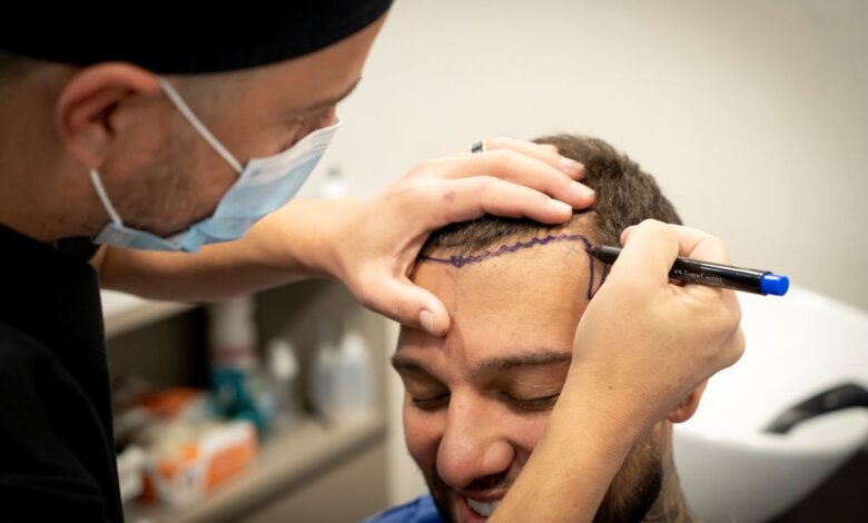 How Hair Transplants in Riyadh Restore Confidence