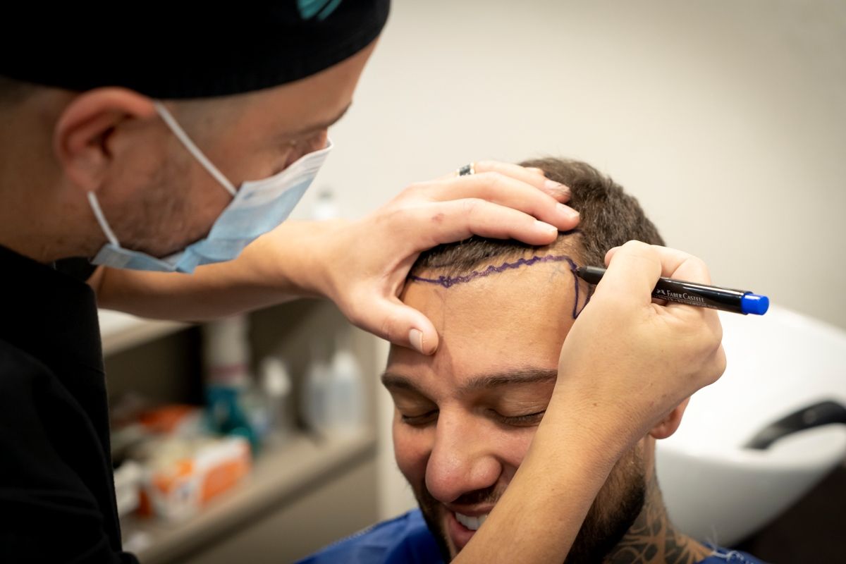 How Hair Transplants in Riyadh Restore Confidence