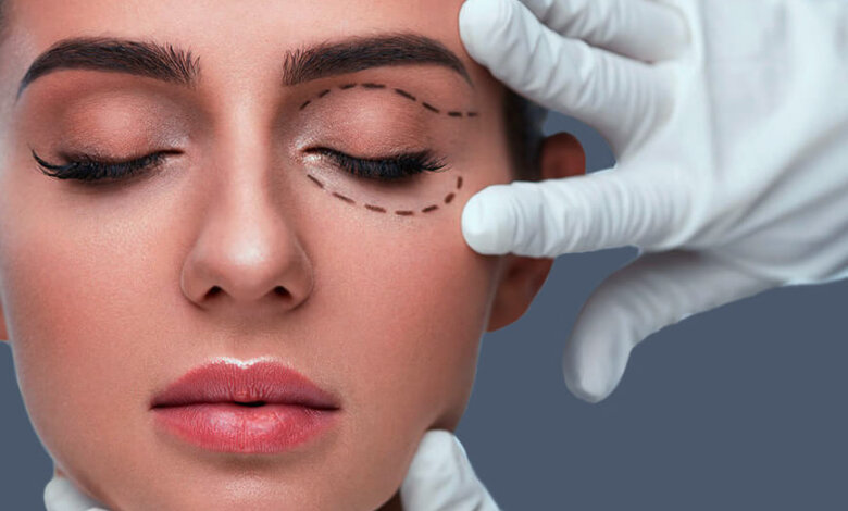 Blepharoplasty Dubai