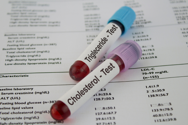 private cholesterol test