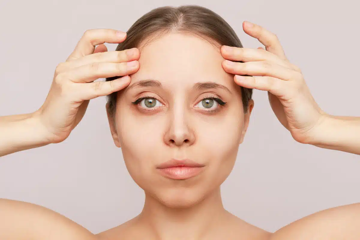 Forehead Lift Dubai