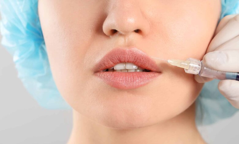 Juvederm filler Dubai