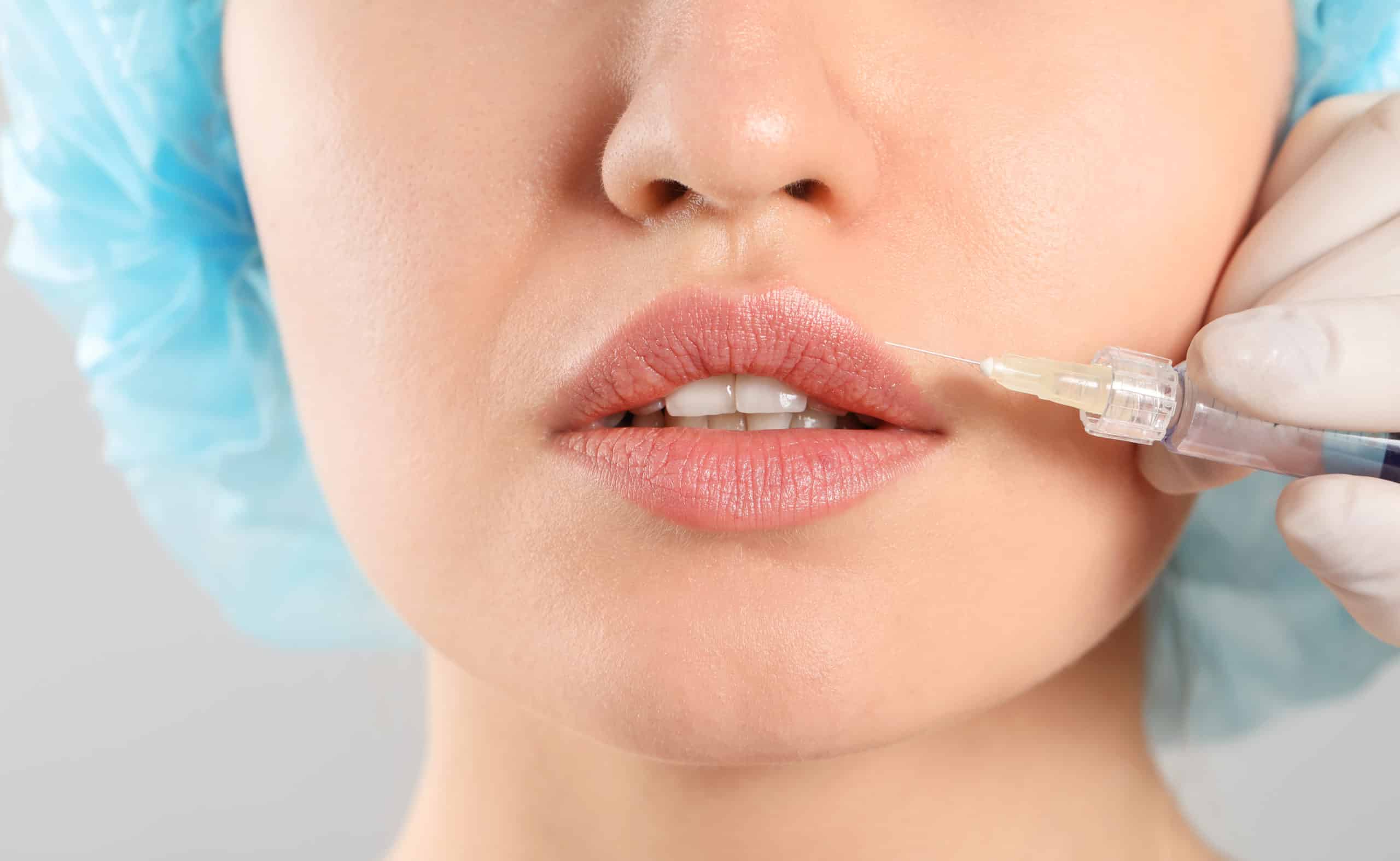 Juvederm filler Dubai