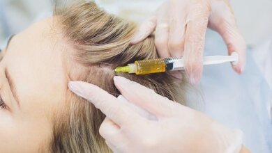 Top Clinics for PRP Hair Treatment Riyadh