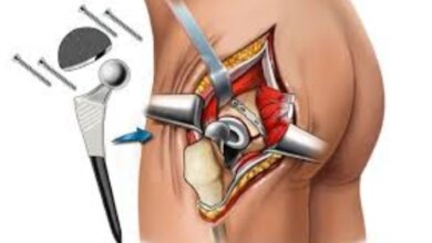 Prostate Cancer Treatment images