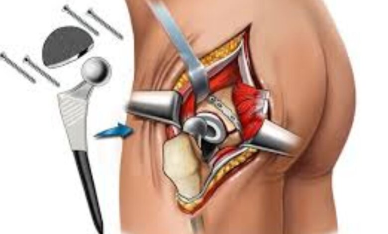 Prostate Cancer Treatment images