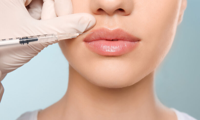 Russian Lip Fillers in Dubai