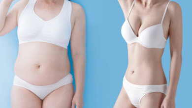 Riyadh Tummy Tuck: What to Expect Before Surgery