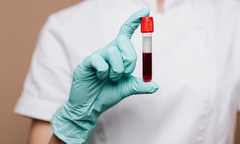 What to Expect from a Blood Test