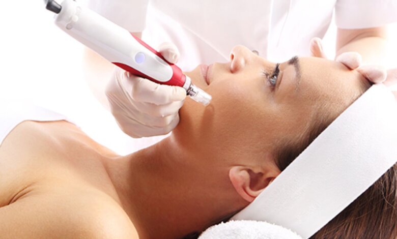 What’s New in Microneedling The Rise of Advanced Dermapen Devices