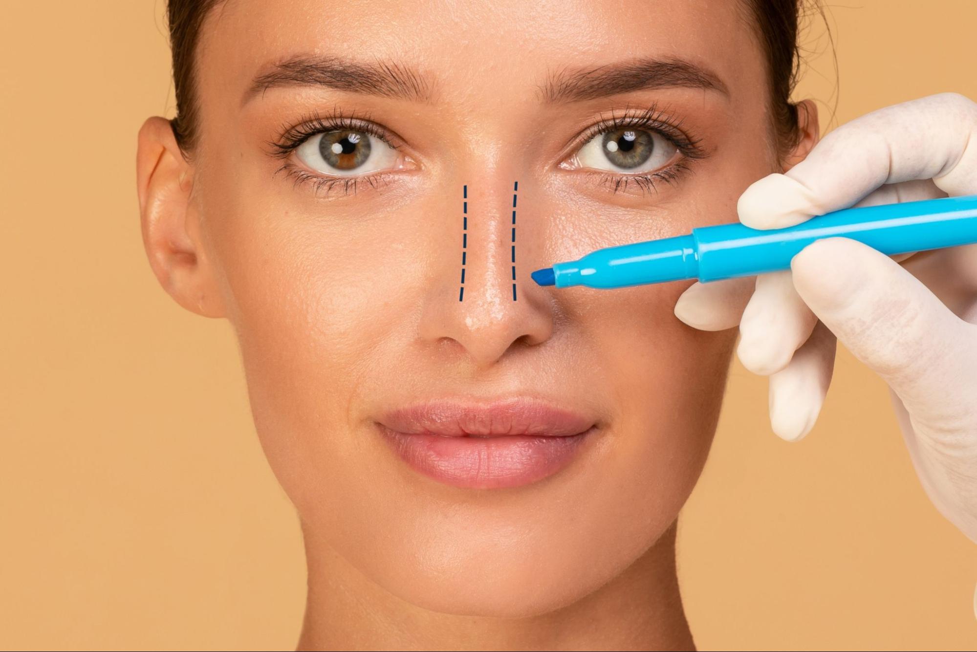 Rhinoplasty Surgery in Riyadh