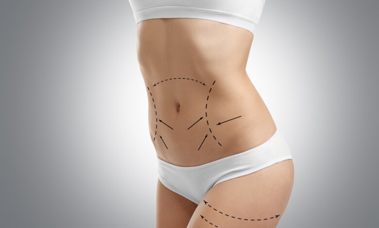 Liposuction in Riyadh
