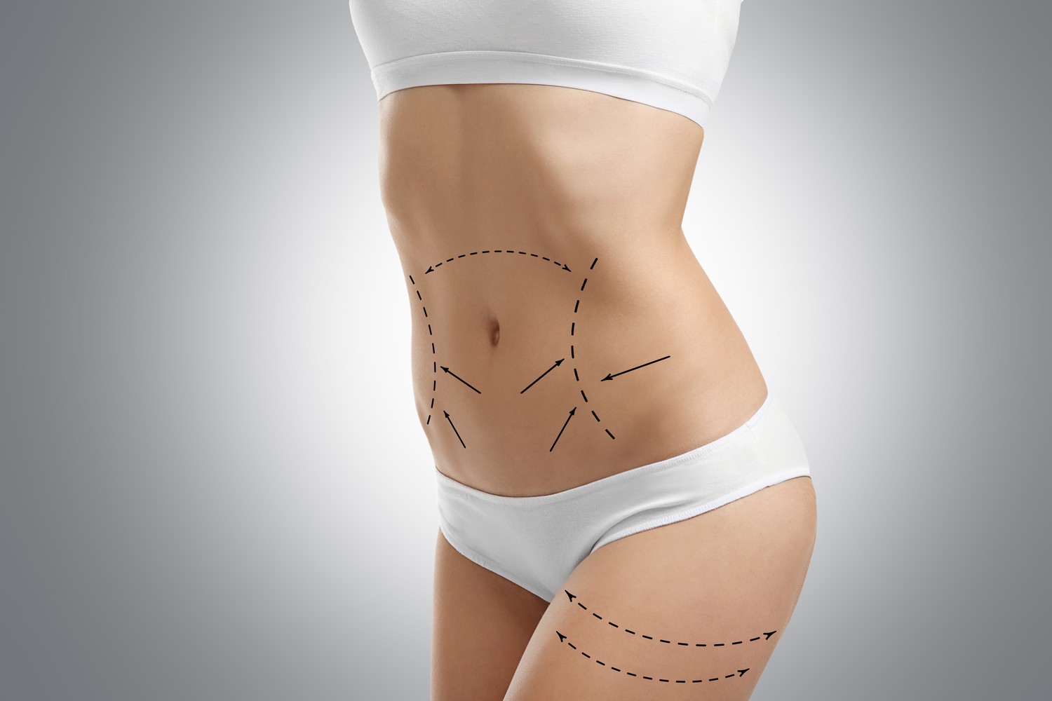 Liposuction in Riyadh