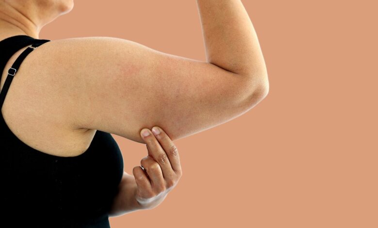 Arm Lift Surgery in Dubai