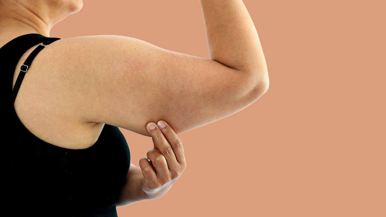 Arm Lift Surgery in Dubai