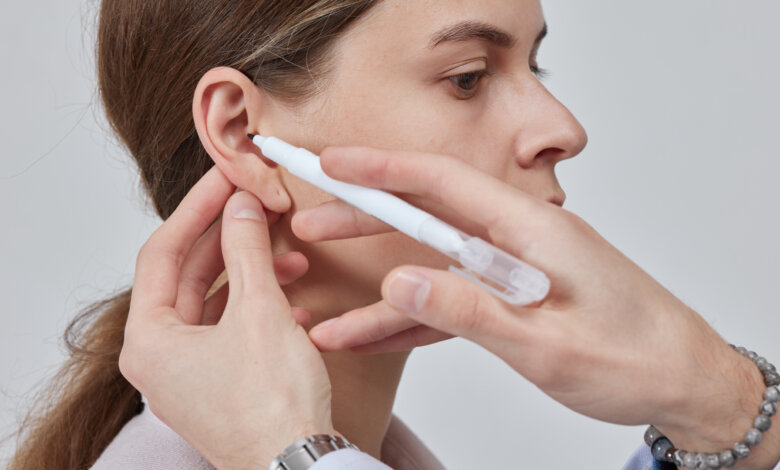 Otoplasty in Dubai