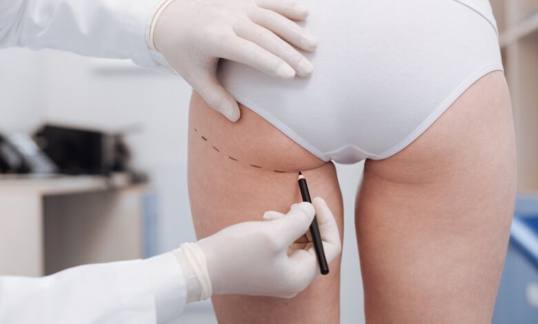 What Plastic Surgeon Offers Brazilian Butt Lift Care?