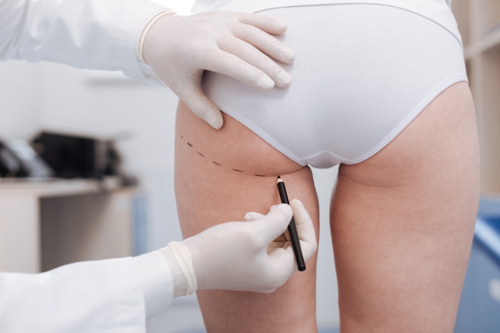 What Plastic Surgeon Offers Brazilian Butt Lift Care?