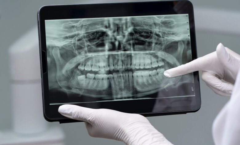 dental x rays services in Oshawa