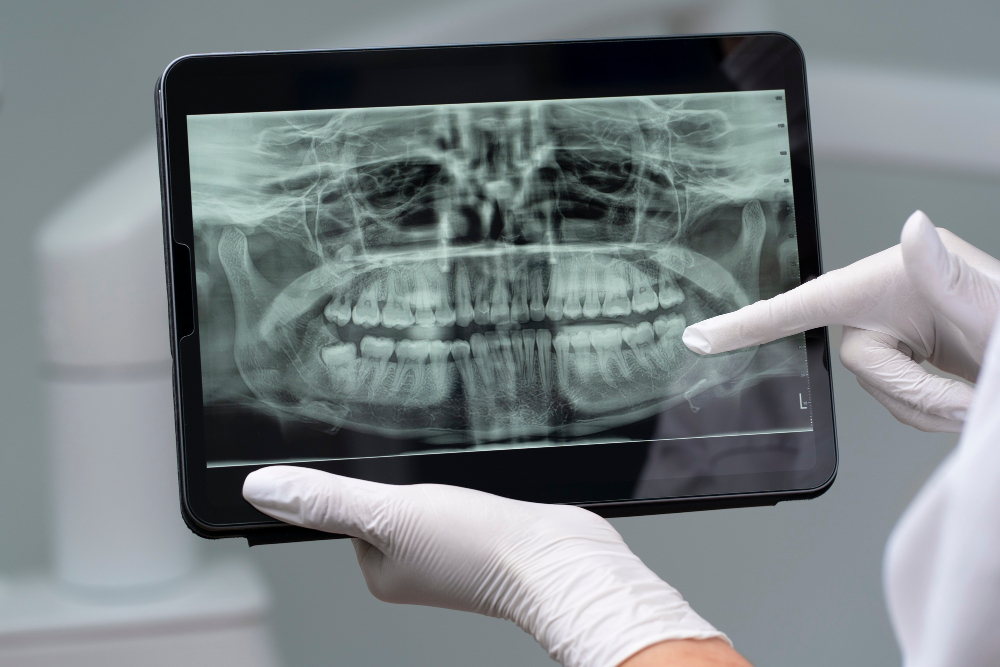 dental x rays services in Oshawa