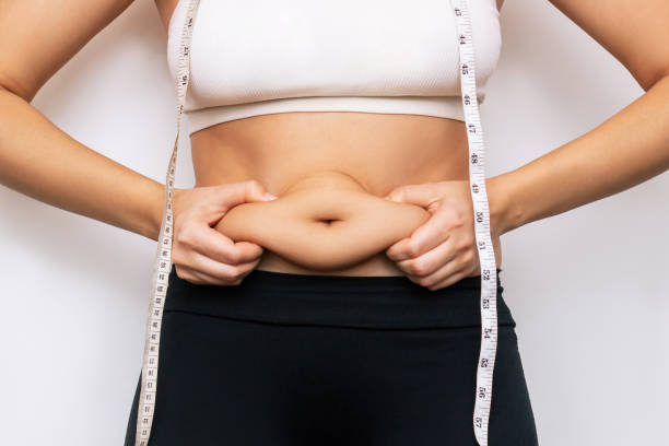 Liposuction surgery in Dubai