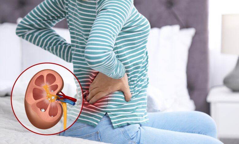 Kidney Stone Treatment in Jaipur