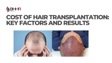 cost hair transplantation