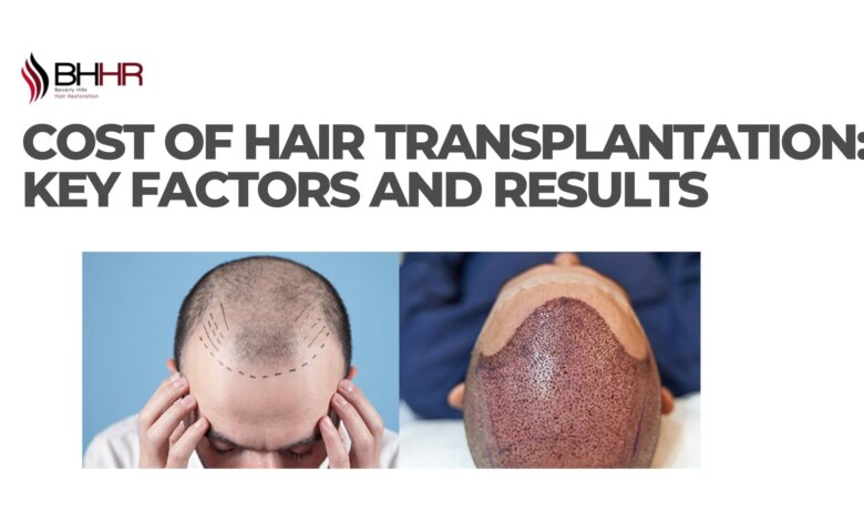 cost hair transplantation