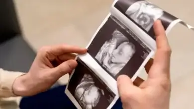 3D, 4D, and HD Ultrasounds