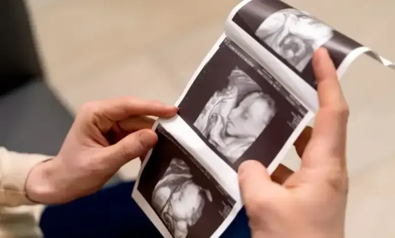 3D, 4D, and HD Ultrasounds