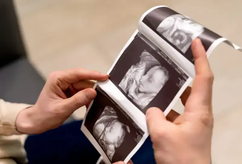 3D, 4D, and HD Ultrasounds