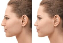 Plastic Surgery/Facial Plastic Surgery