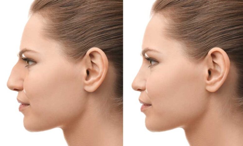 Plastic Surgery/Facial Plastic Surgery