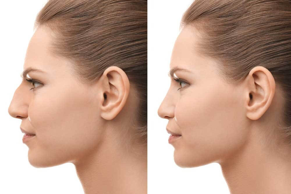 Plastic Surgery/Facial Plastic Surgery